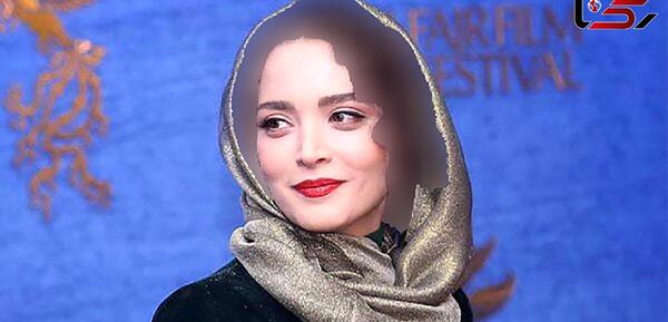 عکس قبل از عمل بینی بهنوش طباطبایی