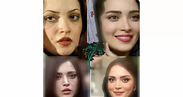 عکس قبل از عمل بینی بهنوش طباطبایی