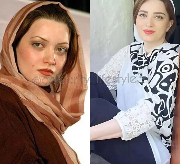 عکس قبل از عمل بینی بهنوش طباطبایی