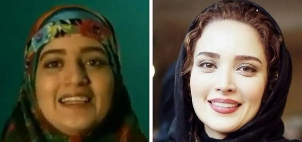 عکس قبل از عمل بینی بهنوش طباطبایی
