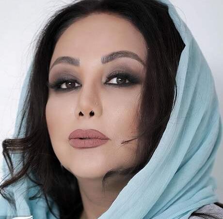 عکس قبل و بعد از عمل بهنوش طباطبایی