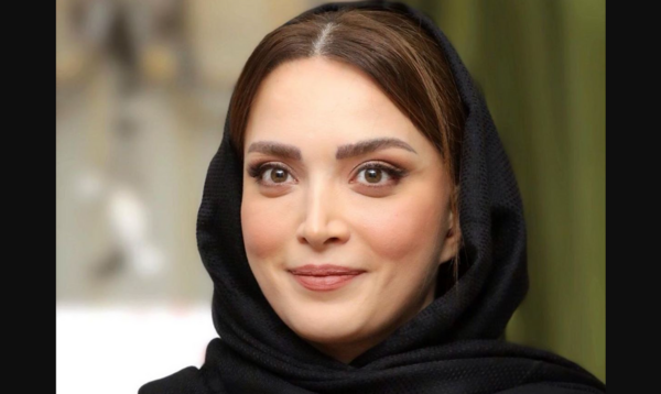 عکس قبل و بعد از عمل بهنوش طباطبایی