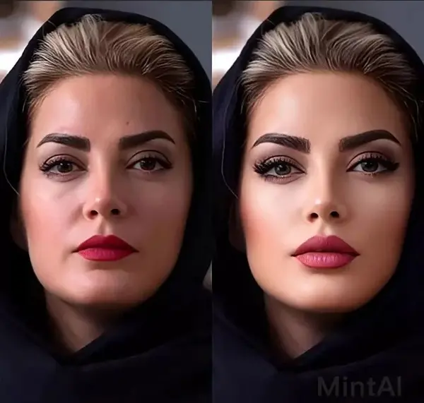 عکس قبل و بعد از عمل بهنوش طباطبایی