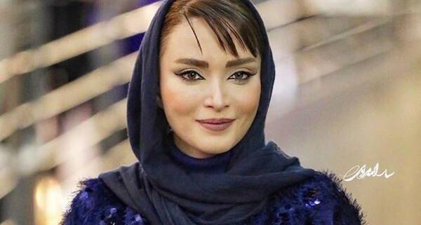 عکس قبل و بعد از عمل بهنوش طباطبایی