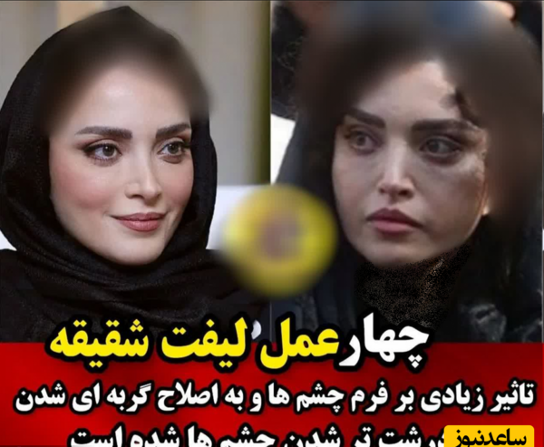 عکس قبل و بعد از عمل بهنوش طباطبایی