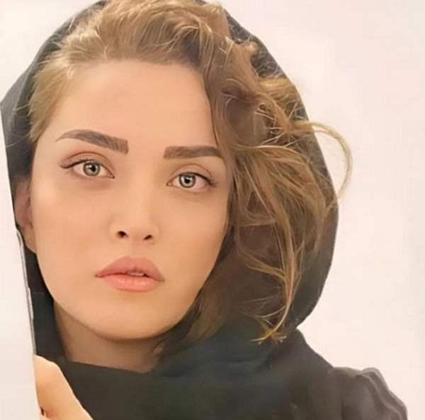 عکس قبل و بعد از عمل بهنوش طباطبایی