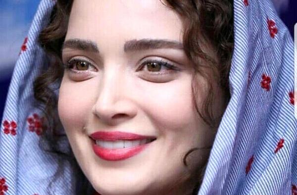 عکس قبل و بعد از عمل بهنوش طباطبایی