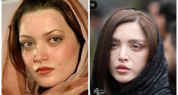عکس قبل و بعد از عمل بهنوش طباطبایی