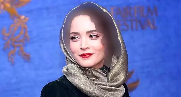 عکس قبل و بعد از عمل بهنوش طباطبایی