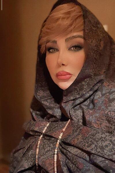 عکس قبل و بعد بهنوش بختیاری
