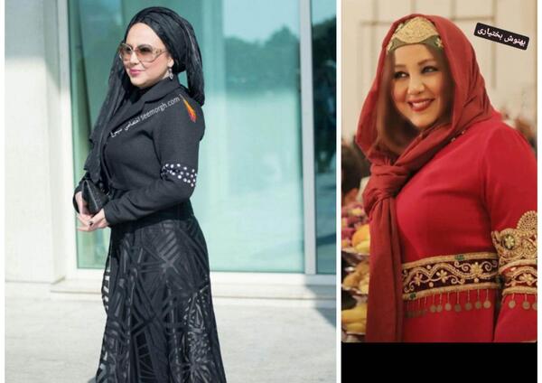 عکس قبل و بعد بهنوش بختیاری