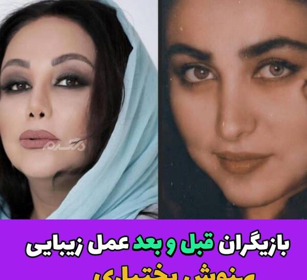 عکس قبل و بعد بهنوش بختیاری