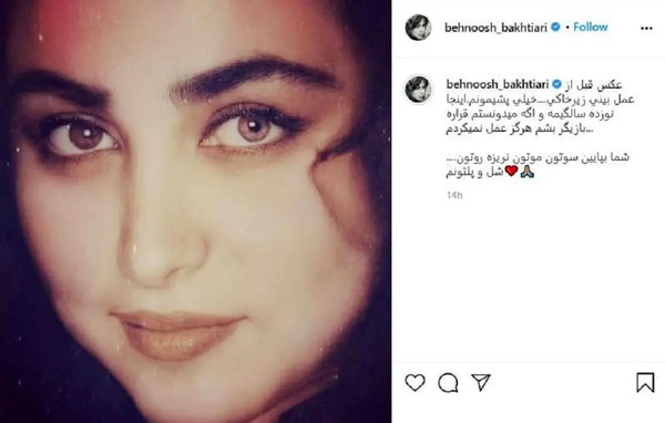 عکس قبل و بعد بهنوش بختیاری