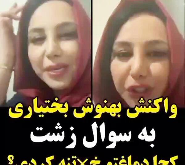 عکس قبل و بعد بهنوش بختیاری