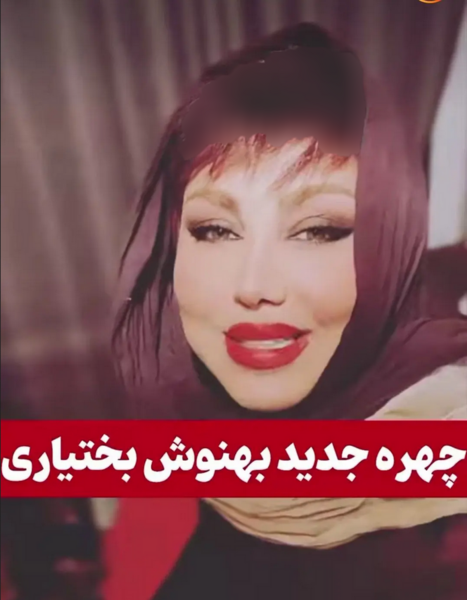 عکس قبل و بعد بهنوش بختیاری