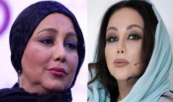 عکس قبل و بعد بهنوش بختیاری