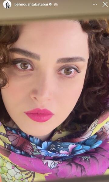 عکس های قبل از عمل بهنوش طباطبایی