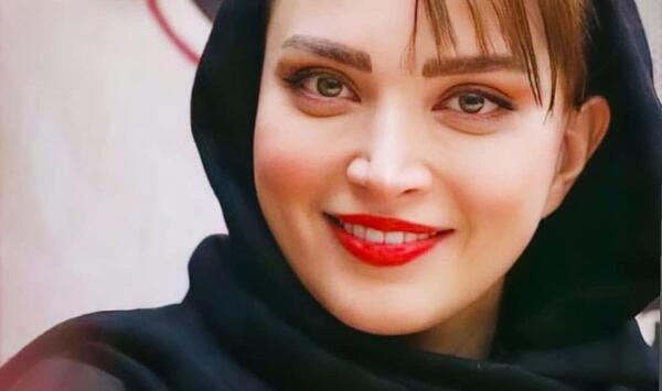 عکس های قبل از عمل بهنوش طباطبایی