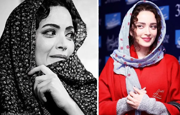 عکس های قبل از عمل بهنوش طباطبایی