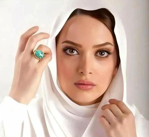 عکس های قبل از عمل بهنوش طباطبایی