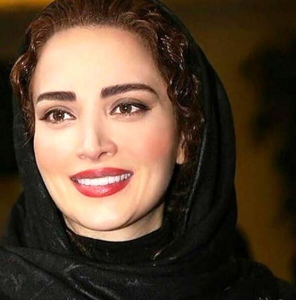 عکس های قبل از عمل بهنوش طباطبایی