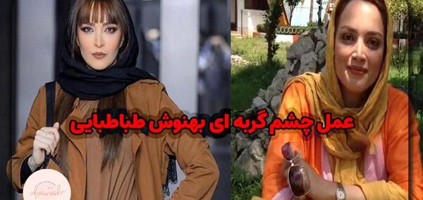 عکس های قبل از عمل بهنوش طباطبایی