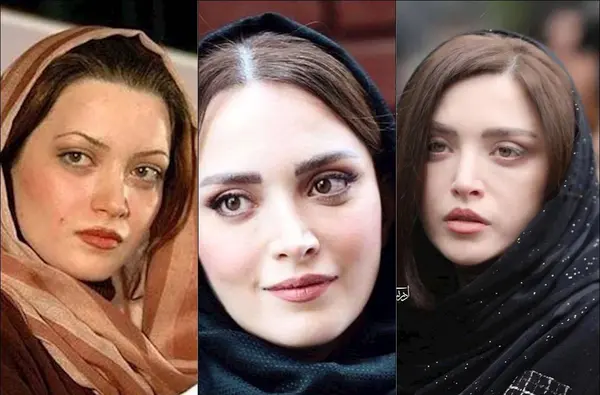 عکس های قبل از عمل بهنوش طباطبایی