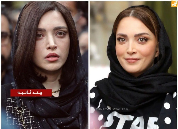 عکس های قبل از عمل بهنوش طباطبایی