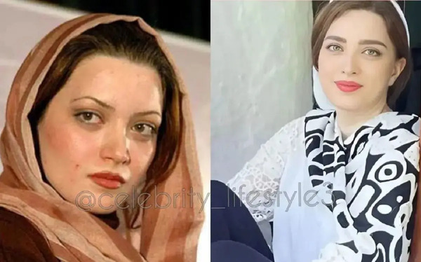 عکس های قبل از عمل بهنوش طباطبایی