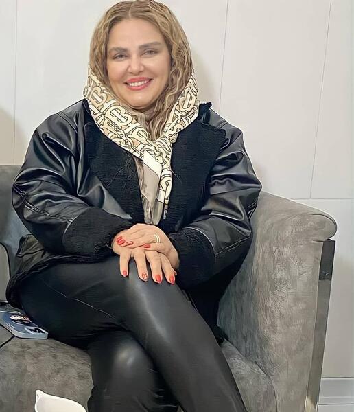 عکس قبل و بعد از عمل بهاره رهنما