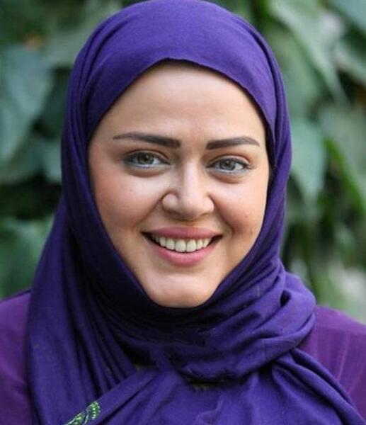عکس قبل و بعد از عمل بهاره رهنما