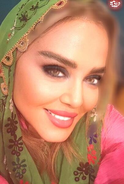 عکس قبل و بعد از عمل بهاره رهنما