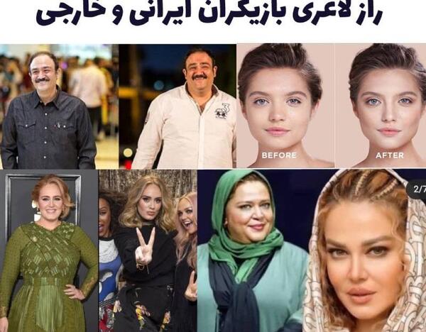 عکس قبل و بعد از عمل بهاره رهنما