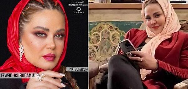 عکس قبل و بعد از عمل بهاره رهنما