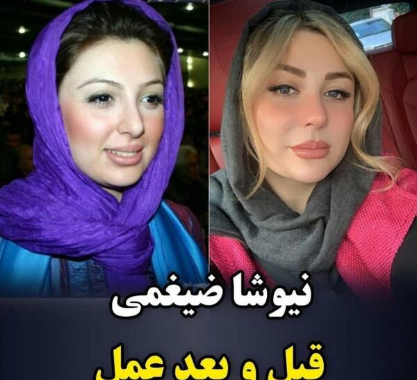 عکس قبل و بعد آرایش بازیگران زن ایرانی
