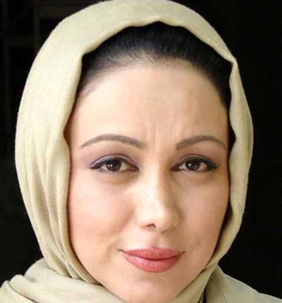 عکس قبل و بعد از عمل بهنوش بختیاری