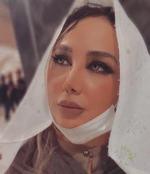 عکس قبل و بعد از عمل بهنوش بختیاری