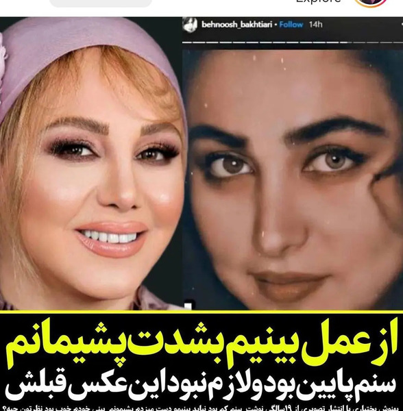 عکس قبل و بعد از عمل بهنوش بختیاری