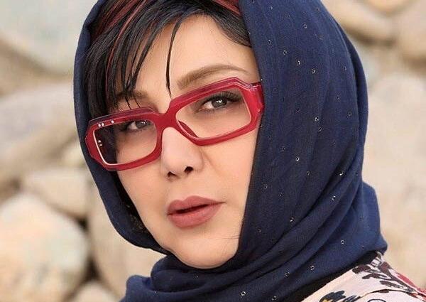 عکس قبل و بعد از عمل بهنوش بختیاری