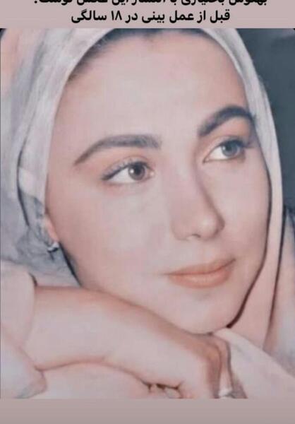 عکس قبل عمل بهنوش بختیاری