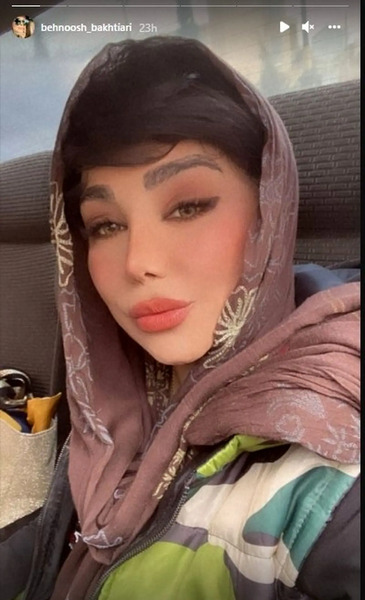 عکس قبل عمل بهنوش بختیاری