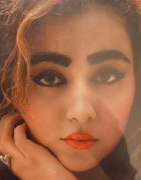 عکس قبل عمل بهنوش بختیاری