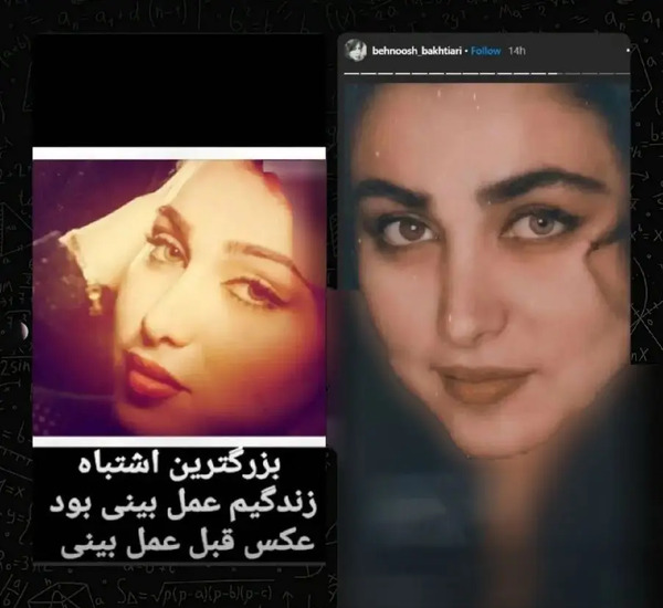 عکس قبل عمل بهنوش بختیاری