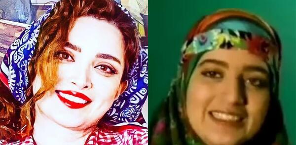 عکس قبل عمل بهنوش بختیاری