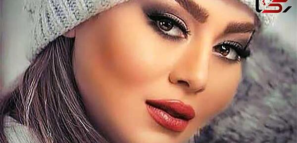 عکس های سحر قریشی قبل از عمل جراحی