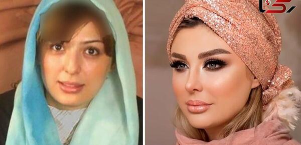 عکس های سحر قریشی قبل از عمل جراحی