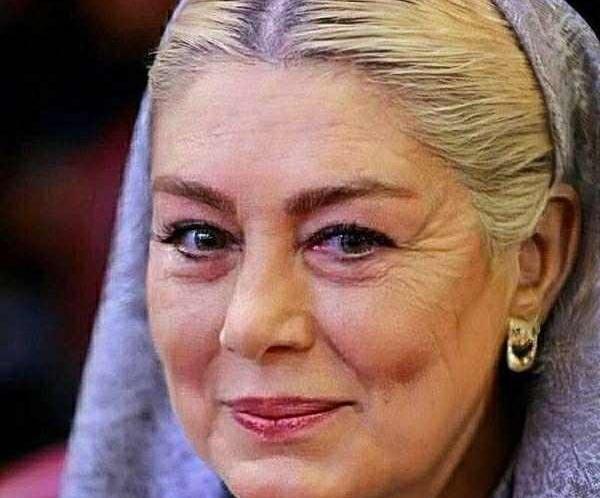 عکس های سحر قریشی قبل از عمل جراحی