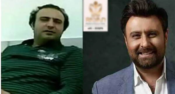 عکس احسان علیخانی قبل از عمل بینی و کاشت مو