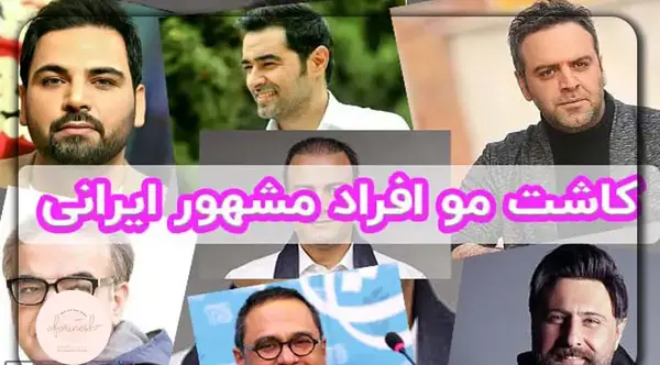 عکس احسان علیخانی قبل و بعد از عمل زیبایی