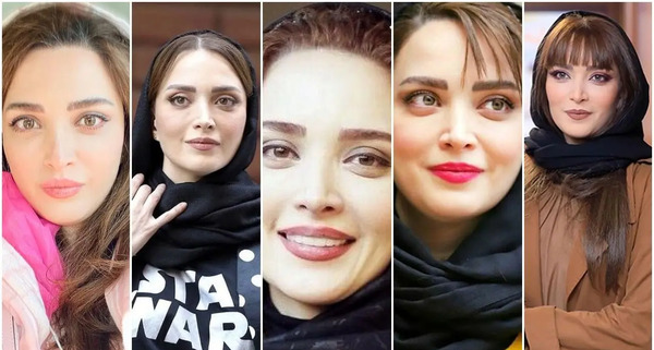 عکس احسان علیخانی قبل و بعد از عمل زیبایی